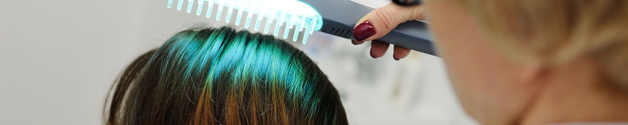 Hair loss treatment being performed on young woman