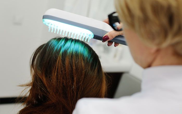 Hair loss treatment being performed on young woman